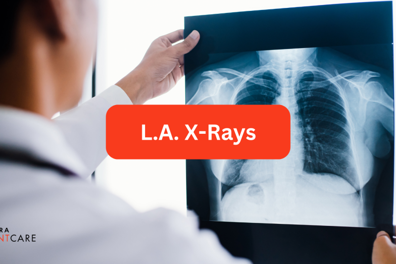 Doctors examining X-rays, highlighting diagnostic imaging services at our Walk-In Clinic in Los Angeles.